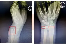 复课第一天，初三男生倒在上学路上……妈妈赶到医院满脸痛心！图片