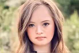 唐氏综合征小美女没有被妈妈放弃，15年后成为美国顶级品牌模特图片