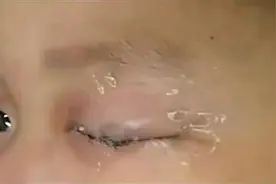 5岁男孩将502滴入眼睛，随后妈妈的应急措施，医生都忍不住称赞图片