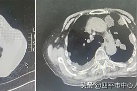 「推介」免疫治疗，肿瘤患者治疗又一利剑图片