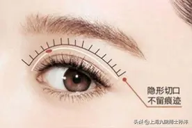 如何做出自然的双眼皮？图片