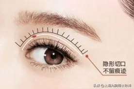 如何做出自然的双眼皮？图片