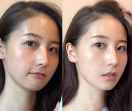 “宝藏女孩”赵露思直播卸妆，看到真实皮肤状态，网友：别化妆了