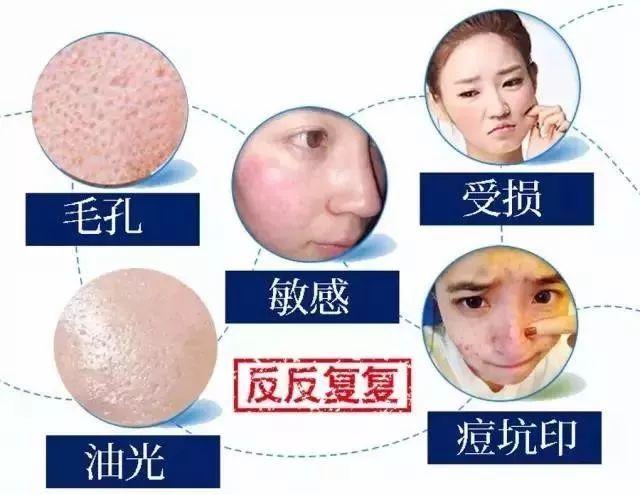 美肌冻干粉有什么作用 美肌冻干粉有什么作用和功效