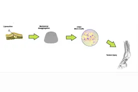 干细胞疗法两月内复原绵羊受伤肌腱图片