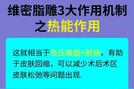 面部吸脂你真的都了解吗？来看看面部吸脂的常见问题解答图片