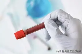 与你有关！血常规检查里的这一项异常可能与癌症有关图片