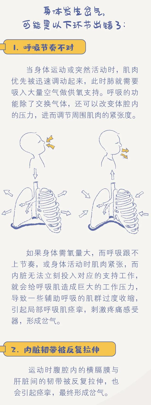 岔气，一种会呼吸的「痛」