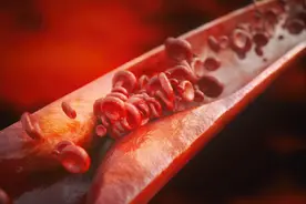 打通血管、清除血栓的秘方存在吗？药师说，通血管的方法只有3个图片