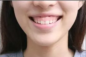 一笑毁所有的颜值杀手——露龈笑图片