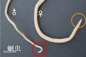 为了搞懂蛔虫在人体内干了些什么，他们竟吃下了千枚蛔虫卵图片