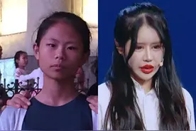 15岁少女已有两年整容经历，花费超400万，低龄化容貌焦虑怎么破图片