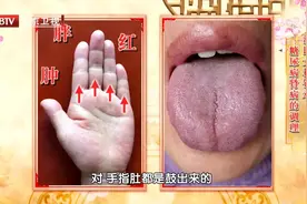 肾不好，手舌有这些特征！一茶一汤一操，护肾强腰图片