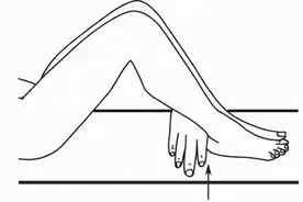 拿起尺子直接量？骨科肢体测量不像看起来那么简单图片