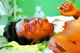 2003年，挖掘机师傅挖出5个金属桶，1人葬送生命，43人受到伤害图片