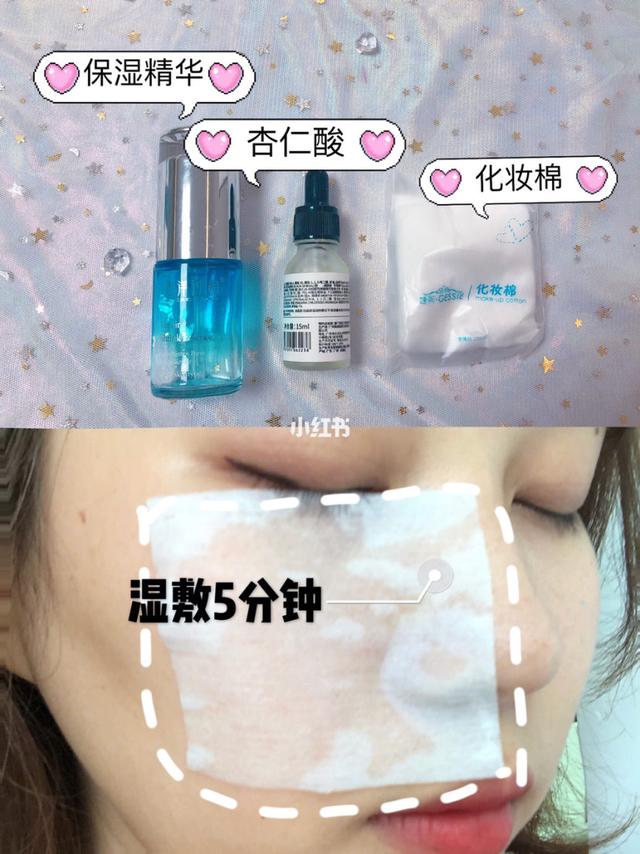 激光去毛周角化症多少钱