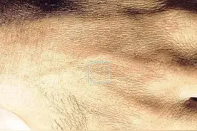 人类皮肤放大了亿万倍后, 呈现出来的形态, 超乎你的想象图片
