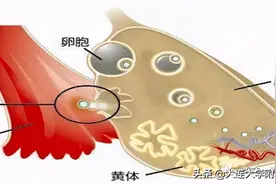 【女性频道】黄体破裂要注意！图片