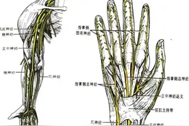 一文读懂丨腕管综合征图片