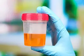 尿蛋白2+,要紧吗？不少肾友只说对了一半图片