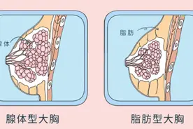 这些胸部小知识，建议男生都替女朋友看看图片