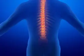 脊柱侧弯矫形器的临床应用图片