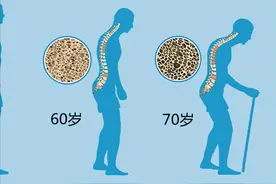 人过了40岁，每10年就会变矮0.84厘米，该怎么办？图片