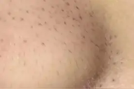 #安心变美课堂##我的安心变美推荐# 挤了这么多年黑头，居然是个“假黑头”...图片