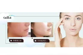 塑造小V脸，提升颜值，让你更佳上镜图片