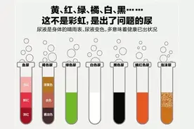 尿液的颜色与疾病图片