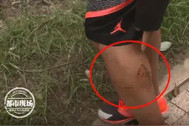 男子在小区遛狗，突然发生打斗！“劝架中”男子被咬伤图片