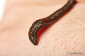 水蛭如果不小心被喝进肚子里，它能在人肚子里长期存活吗？图片