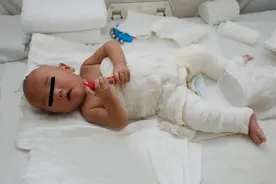 男婴被100℃热水烫伤，妈妈的急救方法，连医生都忍不住点赞图片