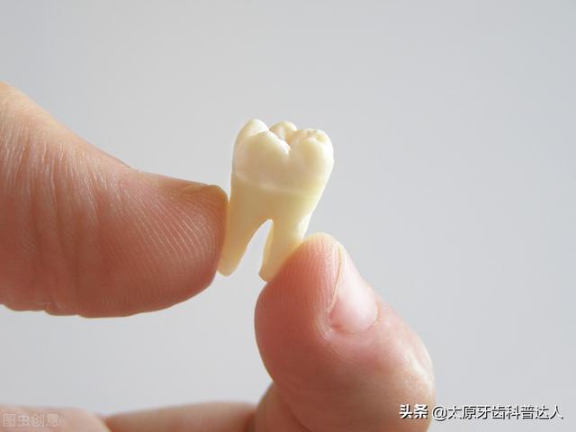 为什么医生都建议最好不要拔虎牙?