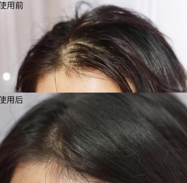 年纪轻轻就有秃顶危机？防脱发洗发水走起，秀发慢慢“柔顺亮滑”