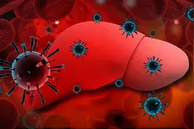 得了肝硬化，饮食更要注意了，遵守这几点，才能改善病情图片