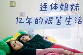 摄影记录墨西哥连体姐妹共用身体12年生活图片