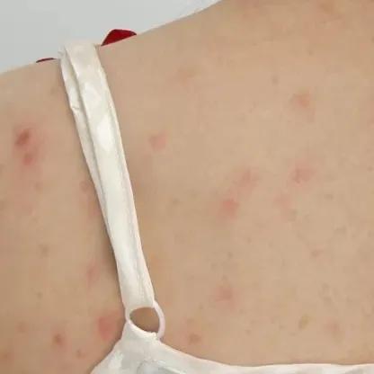 野脚鸡皮肤穿裙子 野脚鸡皮肤穿裙子