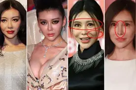 明星整容后样子看起来变得很凶，想整容的朋友需谨慎图片