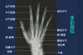 收藏！全身X线图谱，阅片必备图片