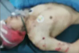 险些丧命！陕西一村民找牛被熊袭击，为保护动物，被咬伤能赔多少图片