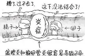 备孕科普：结扎8年后再要娃，检查才知道粘连的“威力”有多大图片