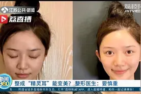 网红称整成“精灵耳”可变美 提醒：将正常耳朵整成畸形 这种手术正规机构不做图片