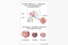 男科专家张广清：前列腺的5叶结构图片