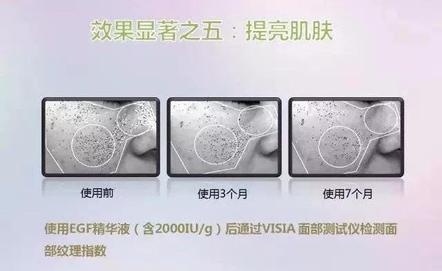 美肌冻干粉有什么作用 美肌冻干粉有什么作用和功效