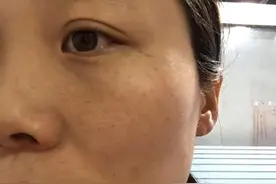 山东大姐为了淡斑美白，每天坚持喝一杯西红柿汁，结果怎样了？图片