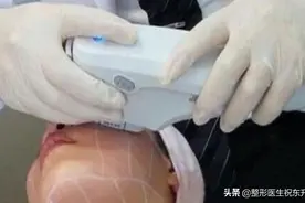 超声刀、热玛吉到底该怎么选？听医生细说图片