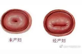 怎样知道女性是否曾生育过孩子？图片