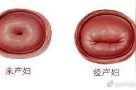 怎样知道女性是否曾生育过孩子？图片
