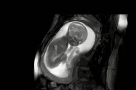 宝宝是从什么时候“认识”妈妈的，有哪些途径呢？真相很暖人图片